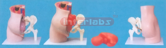 ADVANCED MODEL OF PREGNANCY, WITH PELVIS & FEMORAL HEAD (E TYPE)